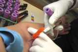 Measles Measles in the U.S. Is Increasing at an Alarming Rate